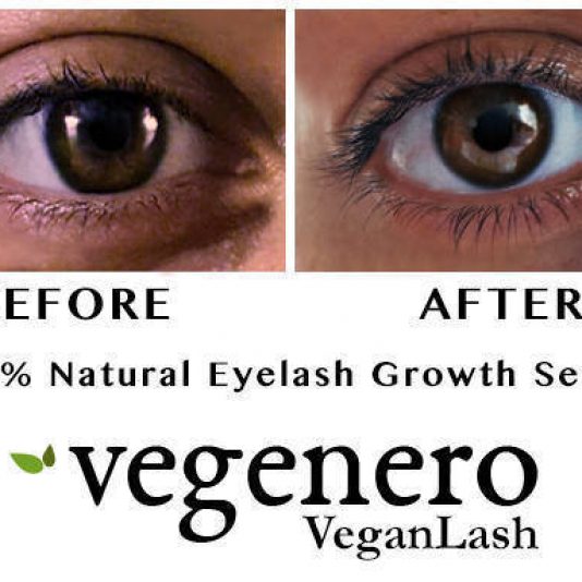 Vegan Lash Natural Eyelash Growth & Eyebrow VegaLash Serum Before and After